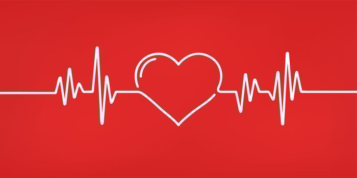 An ECG that forms the shape of a heart.