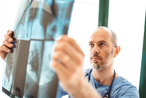 Doctor looking at a lung X-ray.