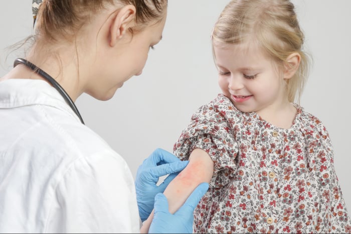 A doctor examines red and itchy eczema on a pediatric patient's arm.