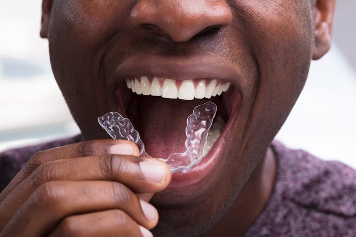 A man smiles while placing a clear dental aligner into his mouth.