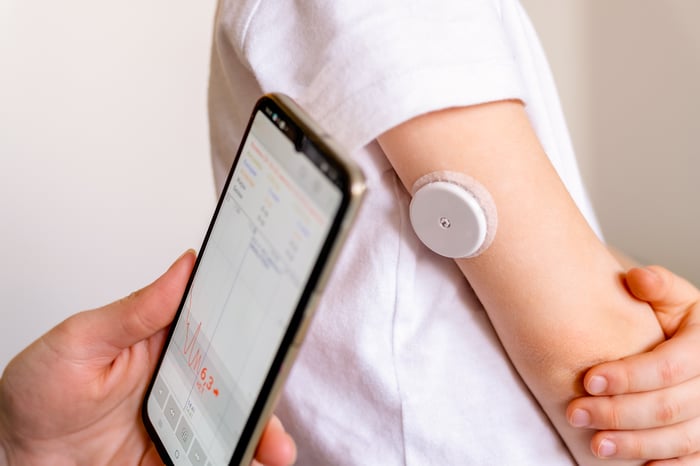 Person using a CGM system.