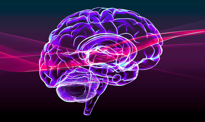 image of brain in purple with pink streak, representing Alzheimer's disease.