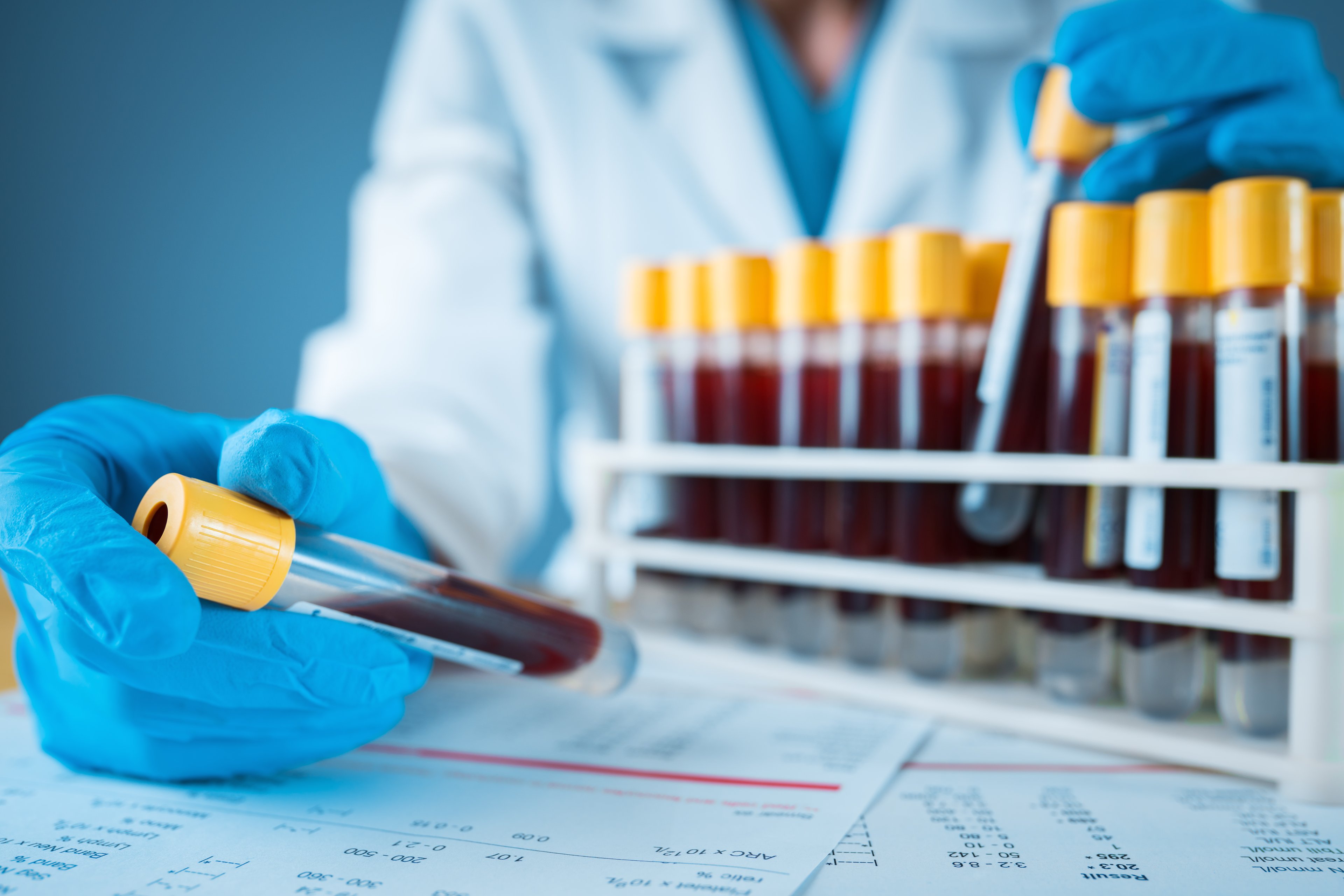 Vials of blood