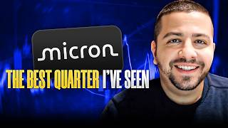 I've Reviewed Thousands of Financial Reports: Micron Just Did Something I've Never Seen Before