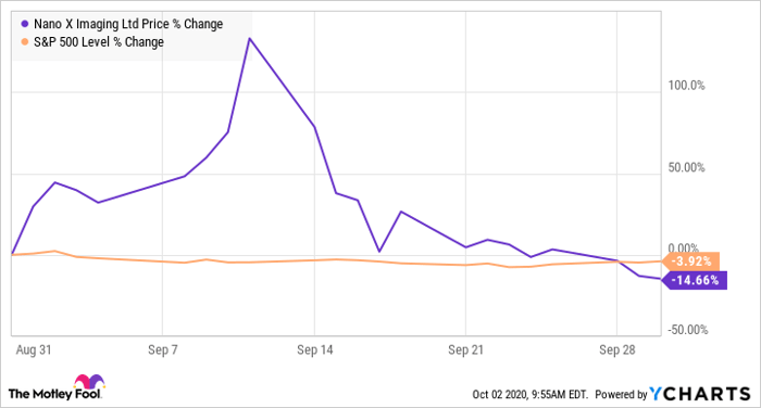 Why Nano X Imaging Stock Fell Almost 15 In September Nasdaq