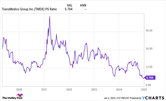 TMDX PS Ratio Chart